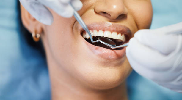 Best Broken or Cracked Tooth Emergency Dentist in Marina, CA